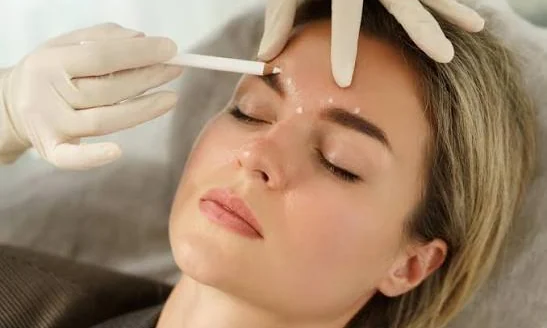 Botulinum toxin injection to the forehead at Beyond Beauty Skin, Laser and Aesthetic Clinic, Vehari