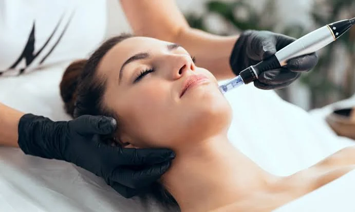 Microneedling pen treatment on the cheek at Beyond Beauty Skin, Laser and Aesthetic Clinic, Vehari