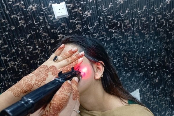 Laser Technology